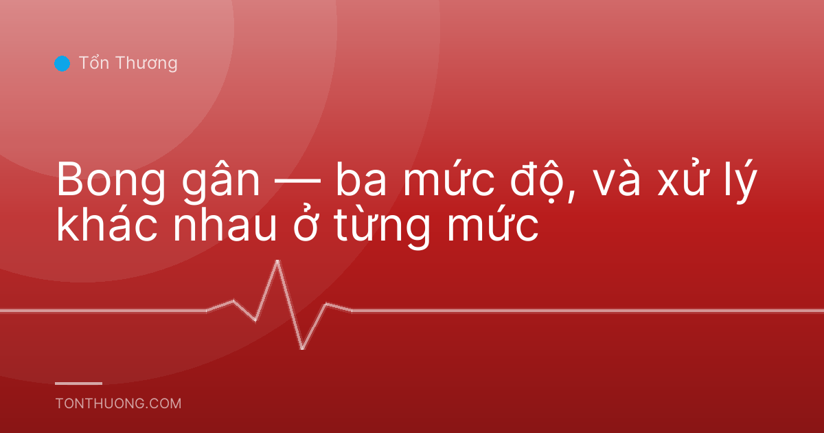 Bong gân — ba mức độ, và xử lý khác nhau ở từng mức